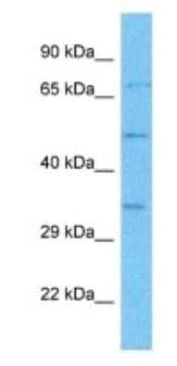 OR4M2 Rabbit anti-Human, Polyclonal, Novus Biologicals:Antibodies:Primary